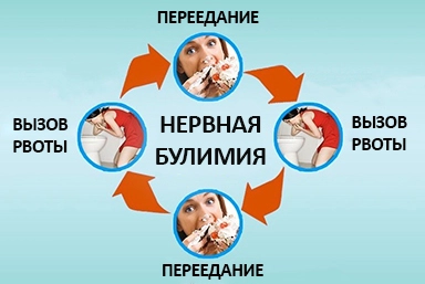 Лечение булимии в Джанкое